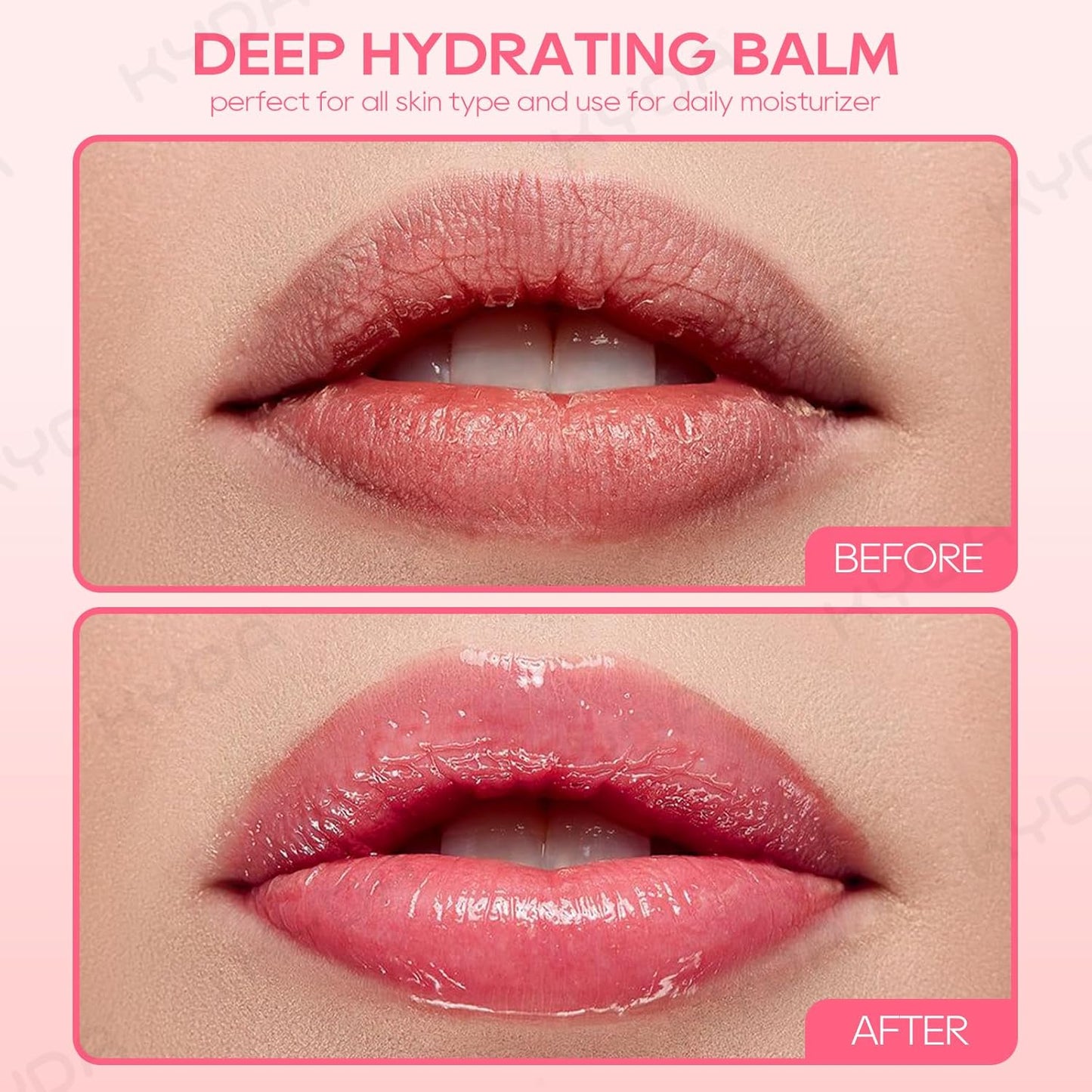 KYDA 3 Pcs Strawberry Moisturizing Lip Balm, Deep Hydrating Tinted Lip Balm, Reduce Fine Lines, Daily Lip Moisturizer for Dry Cracked Lips, with Real Strawberry Extract