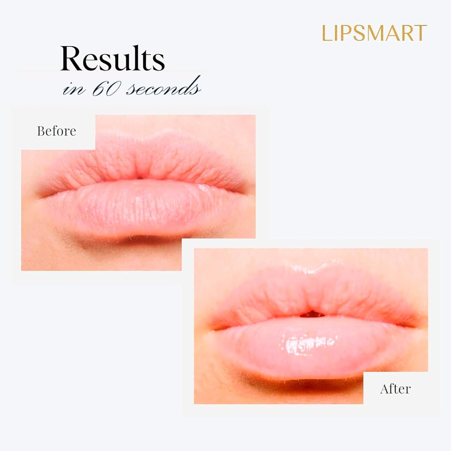 Ultra Hydrating Lip Treatment Moisturizer and Volumizer - Powerful Hydration for Dry Lips (1)