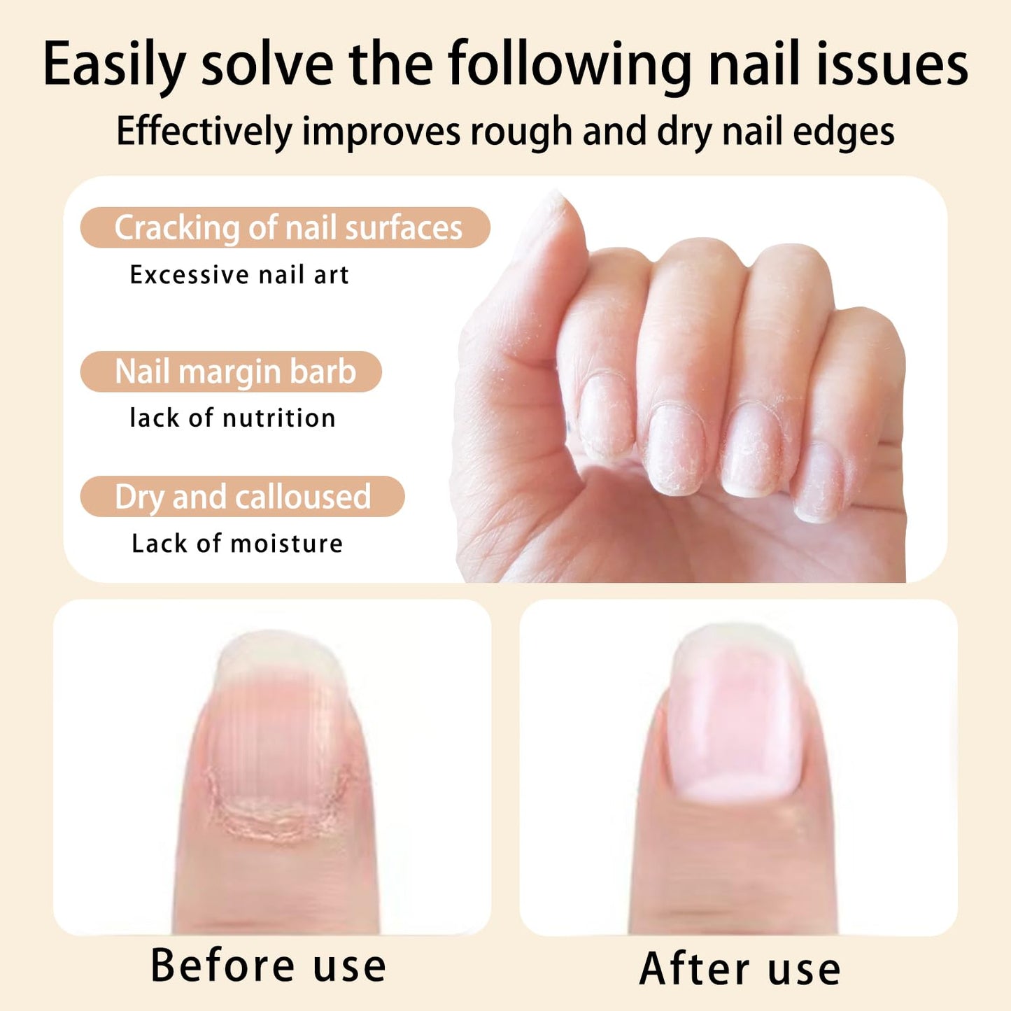 Cuticle Oil Pen Sweet Almond Nail Growth Serum and Repair Treatment Hydrating Oil for Dry Cuticles and Skin Cuticle Buddy Revitalize Nails with Radiant Cosmetics' Nail Growth Oil (6pcs)