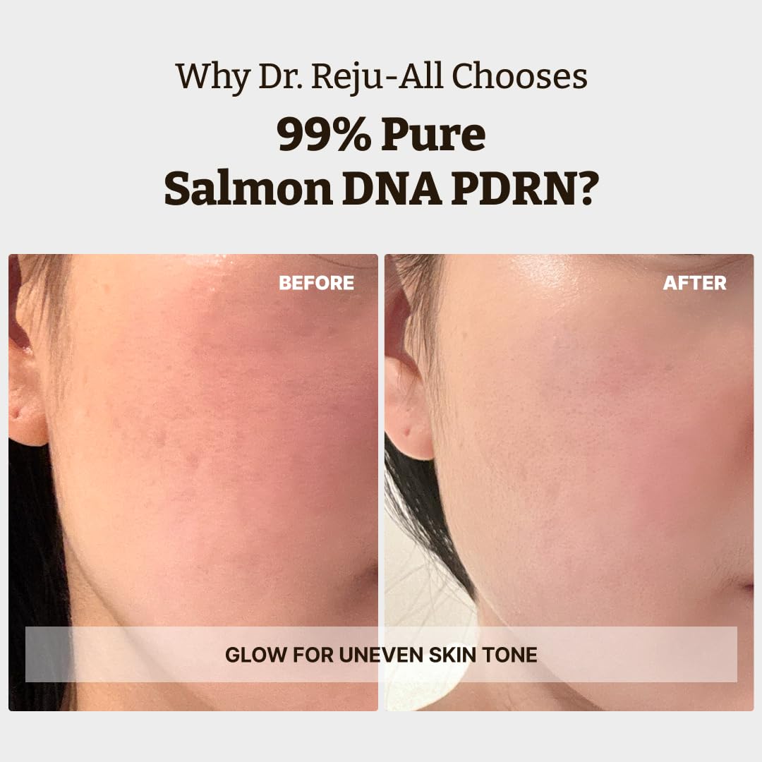 Dr. Reju-All Advanced PDRN Rejuvenating Cream – 99% Pure Salmon DNA PDRN Face Moisturizer – Optimal 1200ppm Concentration for Glow Skin – Korean Anti-Aging Skin Care Face Cream - 2.0 Fl Oz
