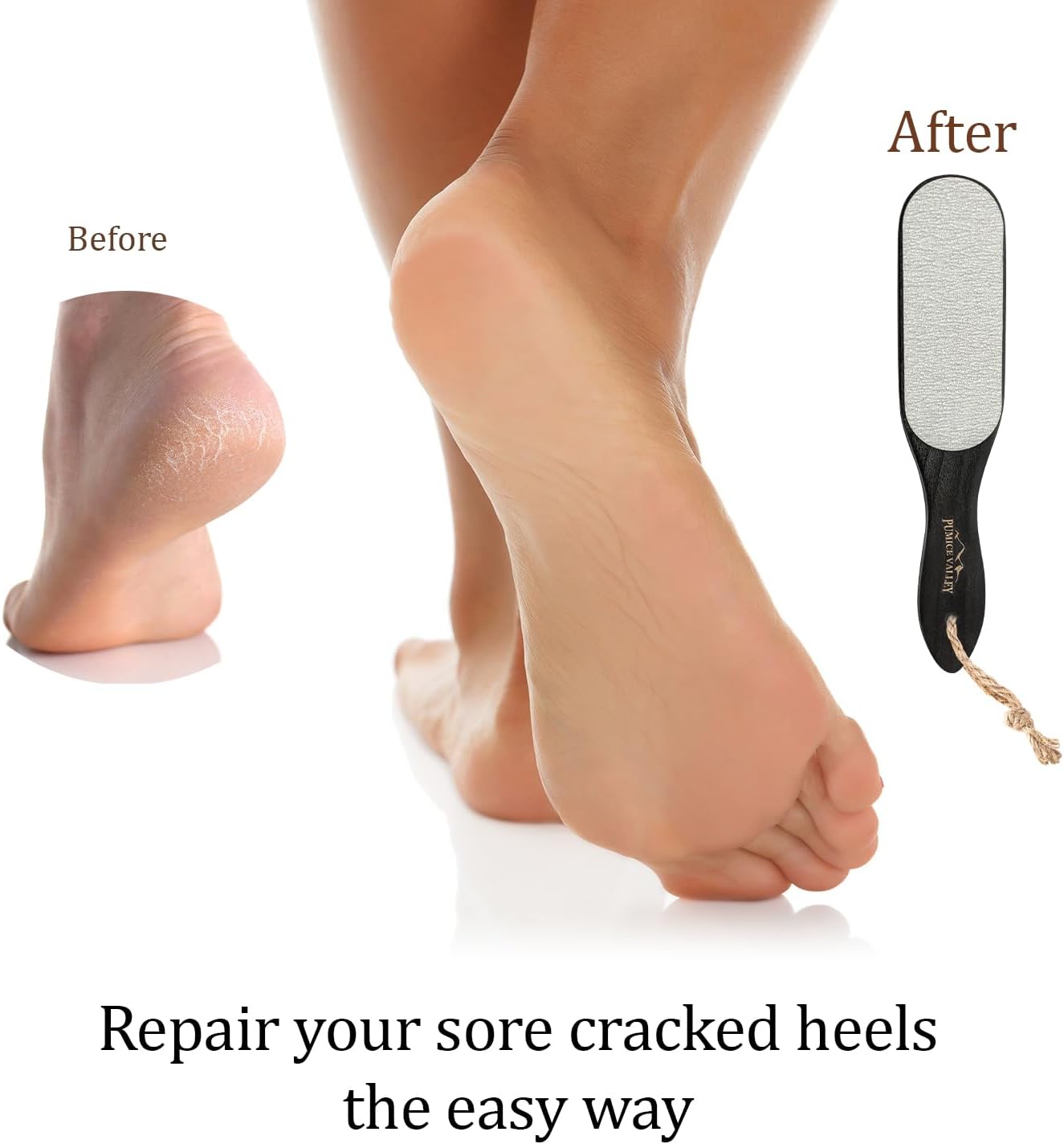 Pumice Stone Foot Scrubber - Pedicure Foot File with Handle for Dry Dead Skin - Callus Remover for Feet - Foot Scraper - Exfoliating Brush for Heels, Elbows, Hands