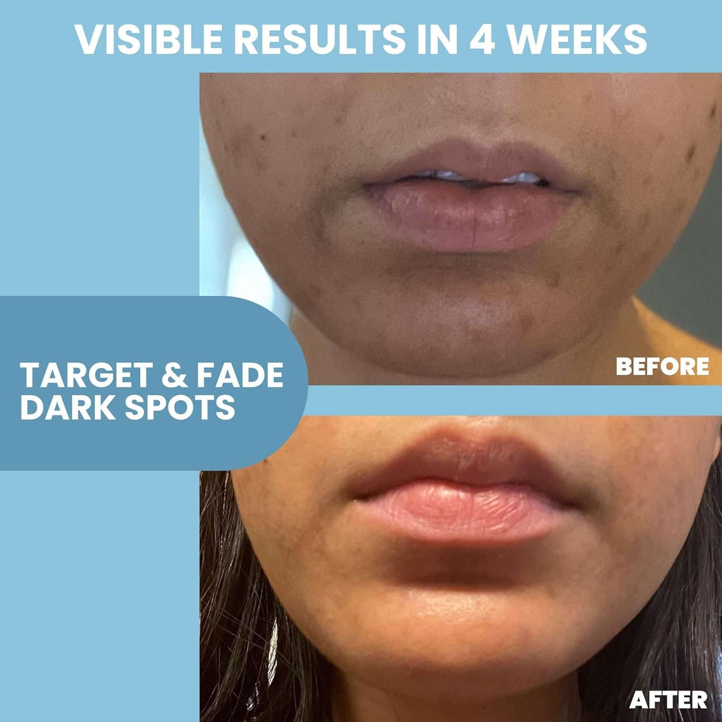 Eva Naturals Niacinamide 12% + Zinc Serum for Face – Dark Spot Remover, Pore Minimizer, Redness Relief, Hydrating Vitamin B3 with Botanical Hyaluronic Acid, Anti-Aging Facial Serum for Clear Skin