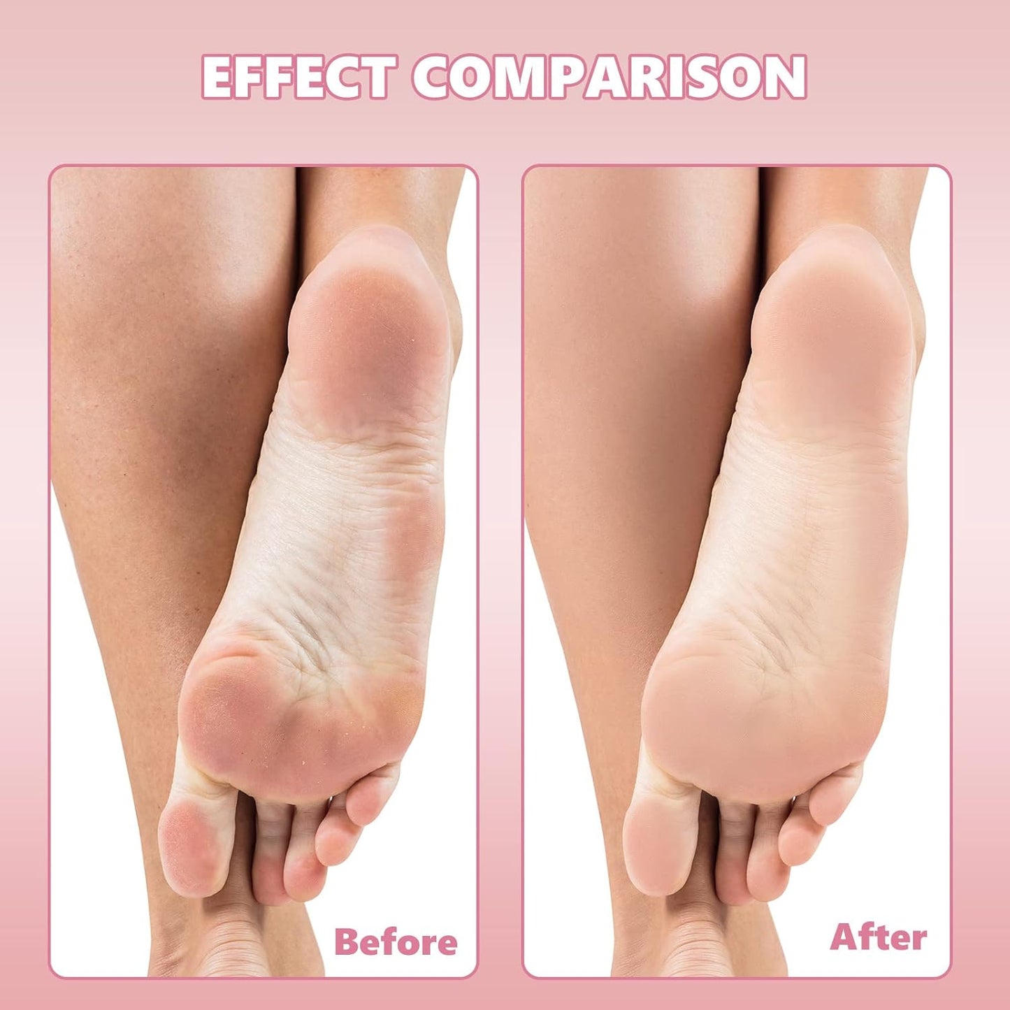 Flutesan 80 Pcs Stainless Steel Foot File Refills 180 Grit and 120 Grit Replacement Pads Coarse Fine Pedicure File Refills Double Side Reusable Foot Rasp Pad with Removable Glue