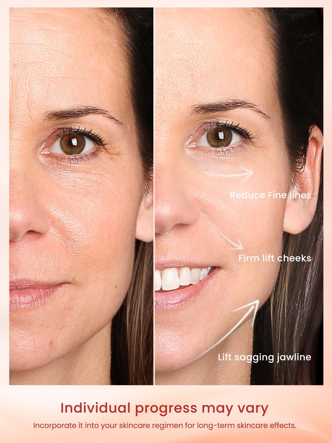 Radio Frequency Skin Tightening Device, Professional Wireless Home RF Face Machine for Anti-Aging, Wrinkle Reduction, Lifting, Firming with 3 Levels