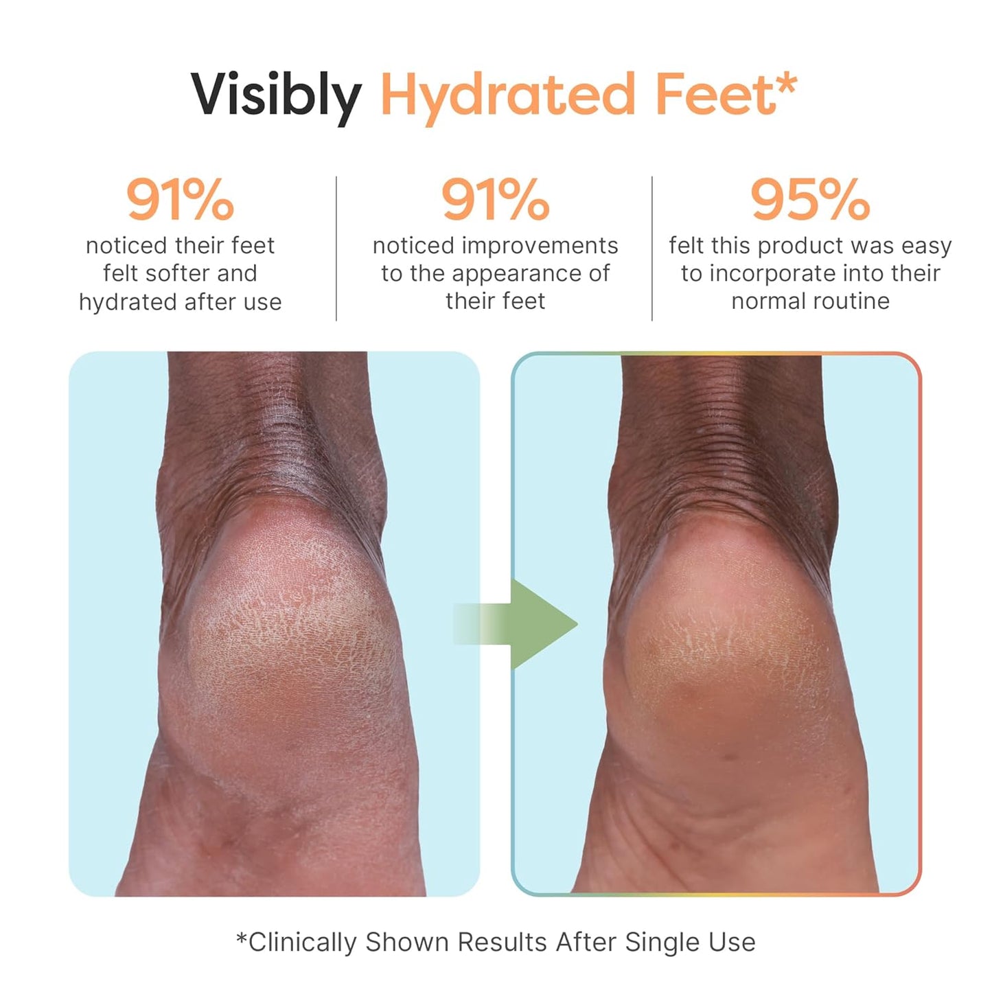 ZenToes Moisturizing Foot Mask for Dry Cracked Feet | Shea Butter, Jojoba Oil & Squalane Infused Hydrating Sheet Masks | Spa Experience At Home | Mess Free Design | Vanilla Citrus Scented, 3 Pairs