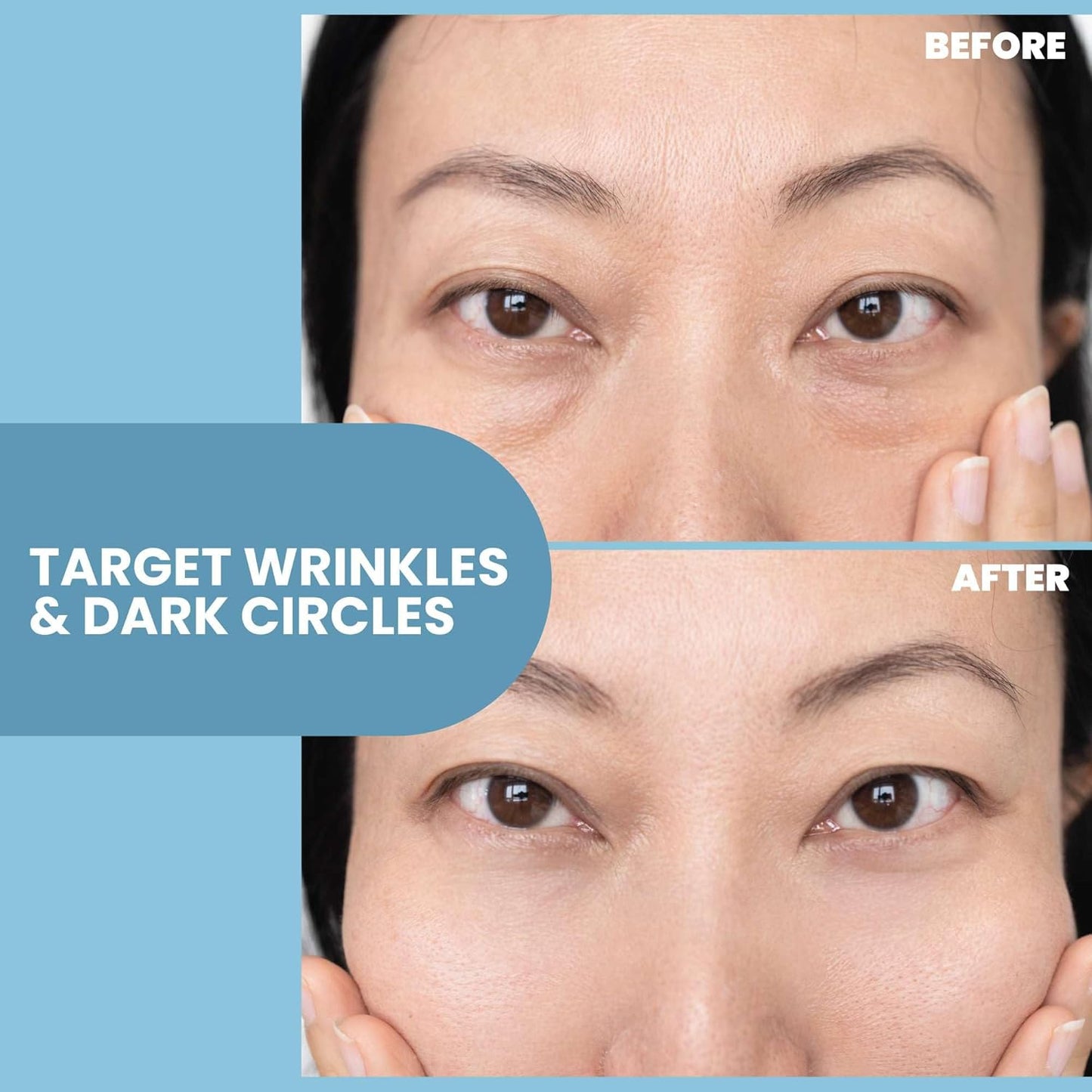 Eva Naturals Eye Gel for Dark Circles, Bags & Puffiness – Anti-Aging Serum with Peptides, Hyaluronic Acid & Botanicals – Firming Under Eye Treatment for Wrinkles, Fine Lines & Tired Skin – 2 oz