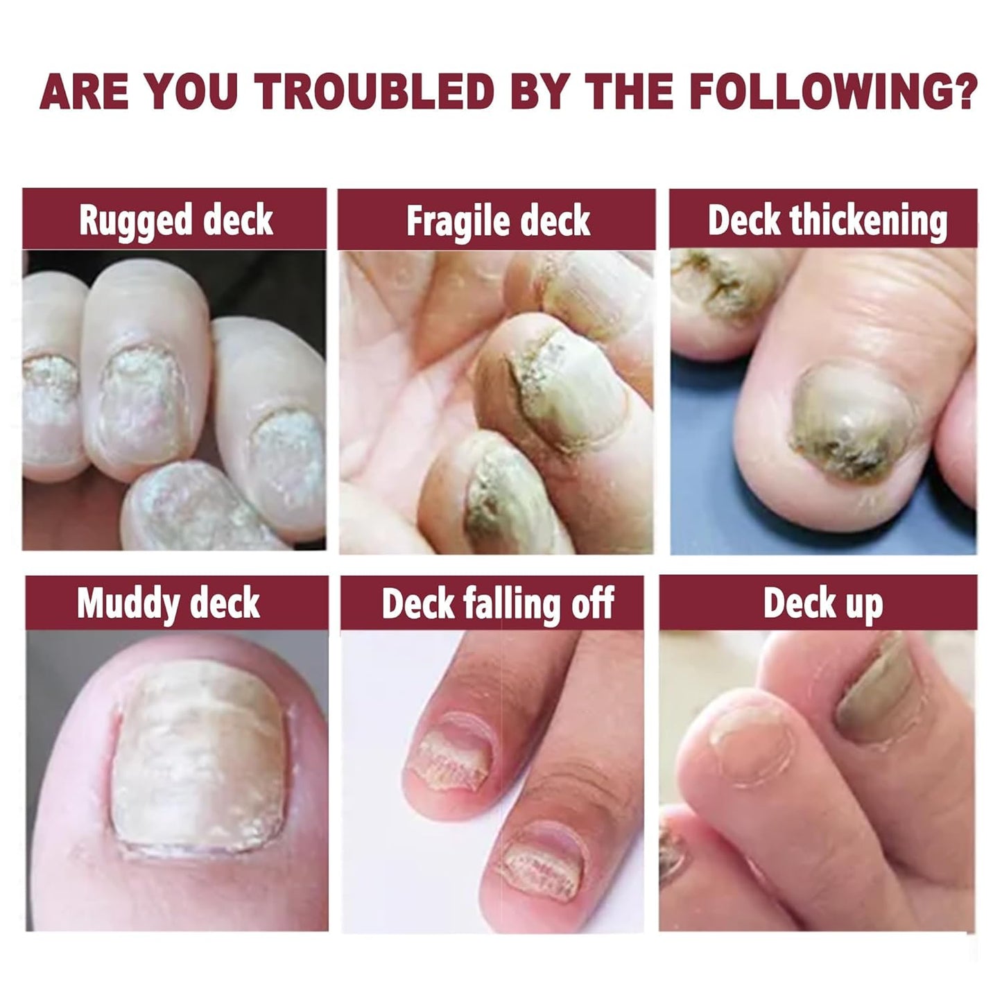 Nail Repair Essence Serum Nail Treatment Multi-Purpose Nail Repair Liquid Solution for Damaged Nails repair for Discolored Nails Ingrown Treatment Extra Strength Nail Care 0.7 Fl Oz