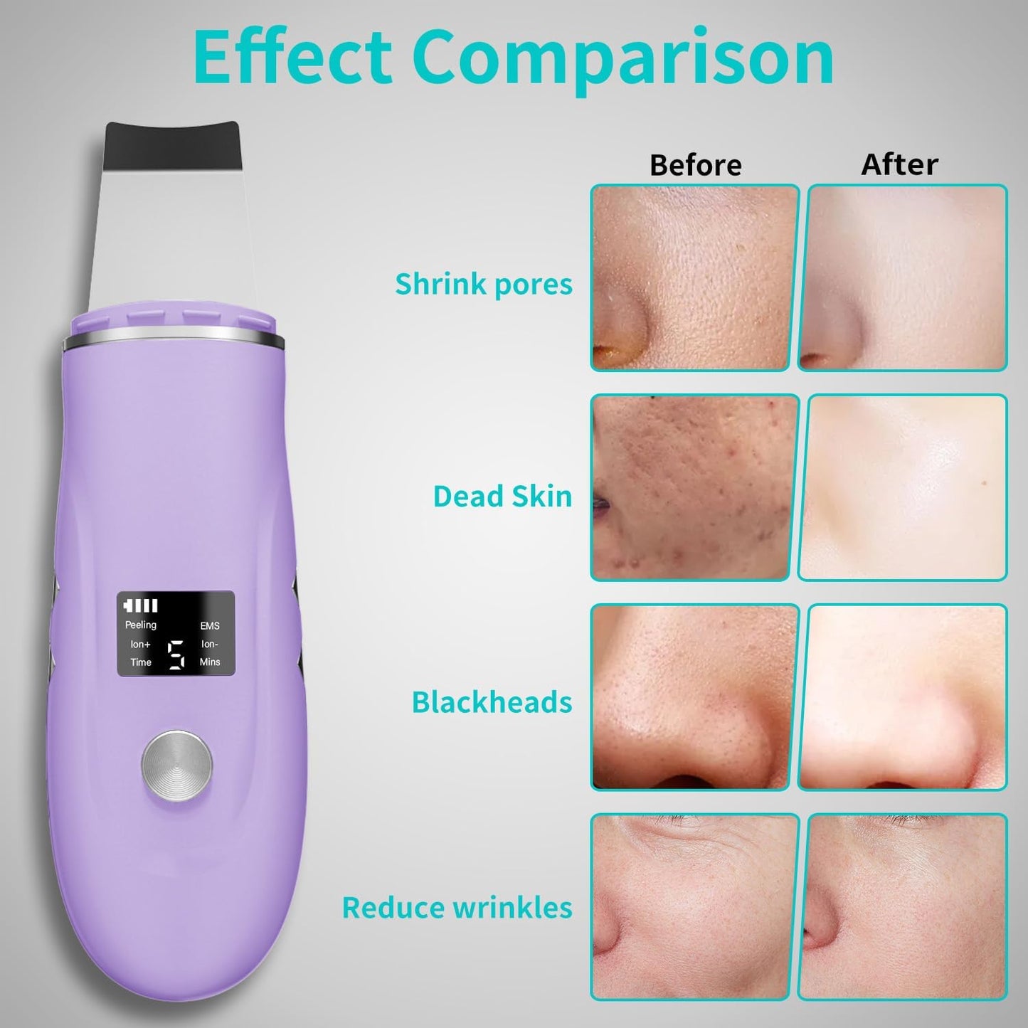 Face Scrubber Skin Spatula - Blackhead Remover Deep Cleansing Tool for Pore Extraction, 4-in-1 Fast Charging Dock Blackhead Remover Face Spatula for Facial Skincare Women Gift (Purple)