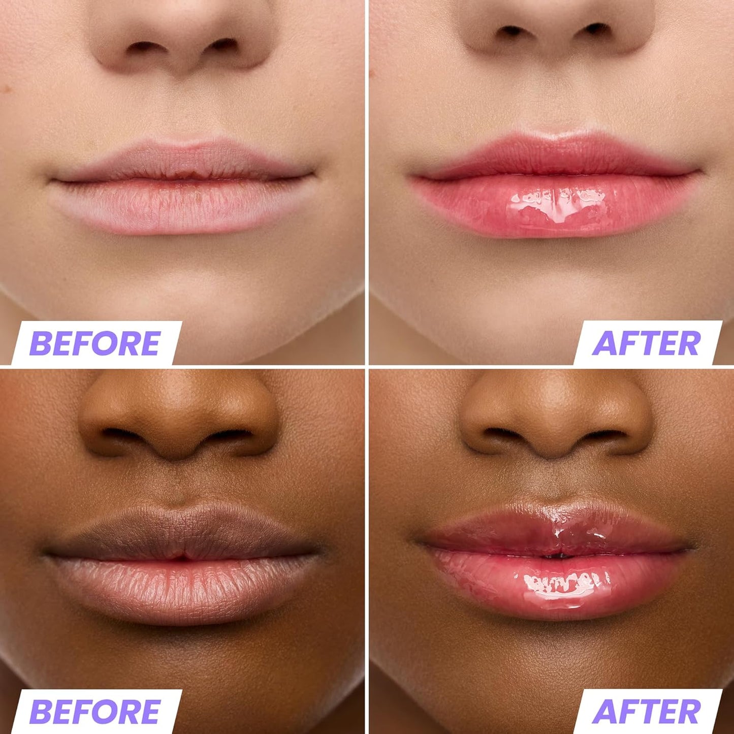 Wonderskin Lip Oil Rehab Serum - Tinted Lip Oil for Women, Hydrating, Moisturizing, and Non-Sticky Red Tint Serum for Dry Lips (Amour)