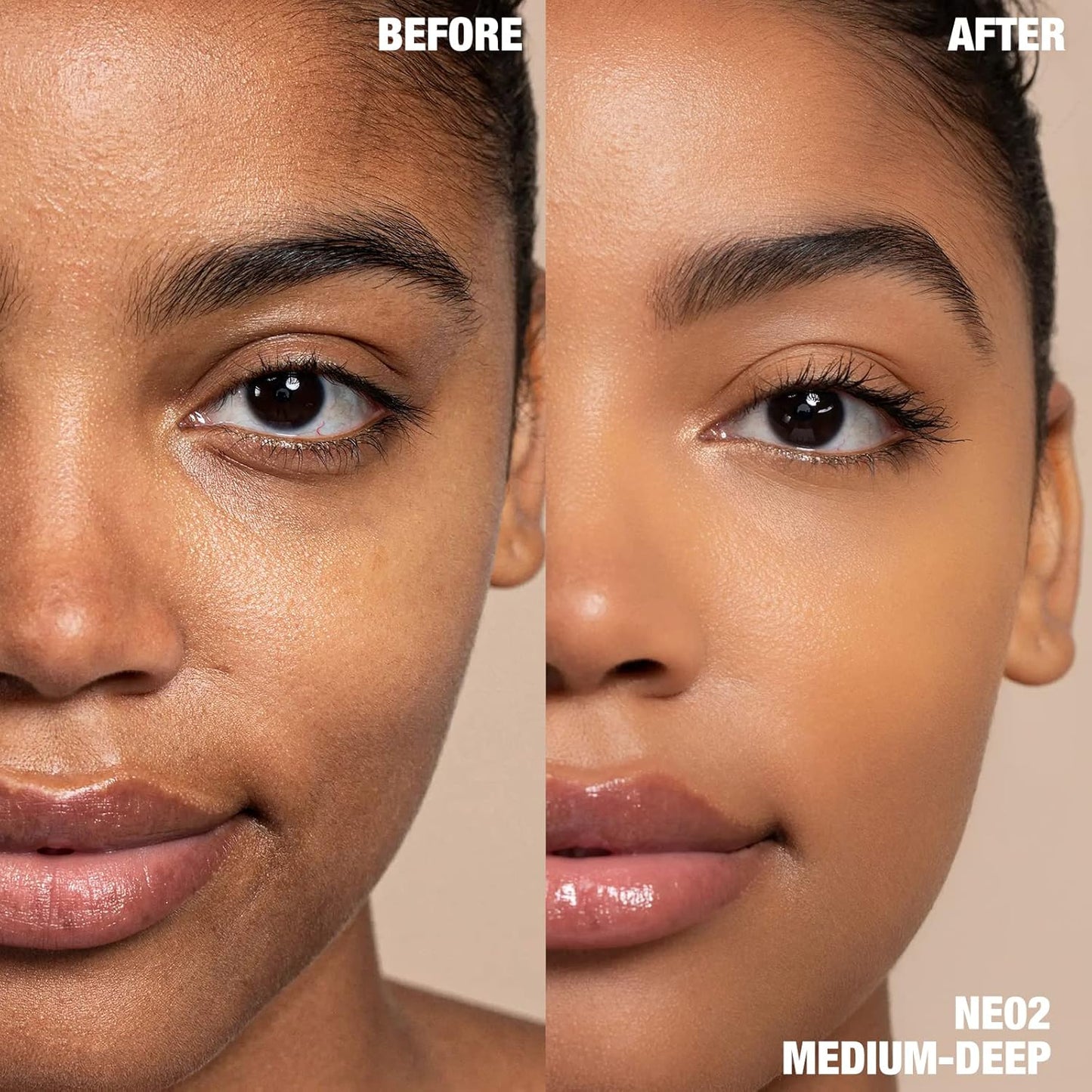 FOCALLURE #GoldenAge 5 in 1 Multi Uses Concealer Palette, 5 Colors Correcting Conceal Palette, Camouflage Contour Palettes for Dark Circles, Face Contouring Highlighter Pallet, NE02 MEDIUM-DEEP