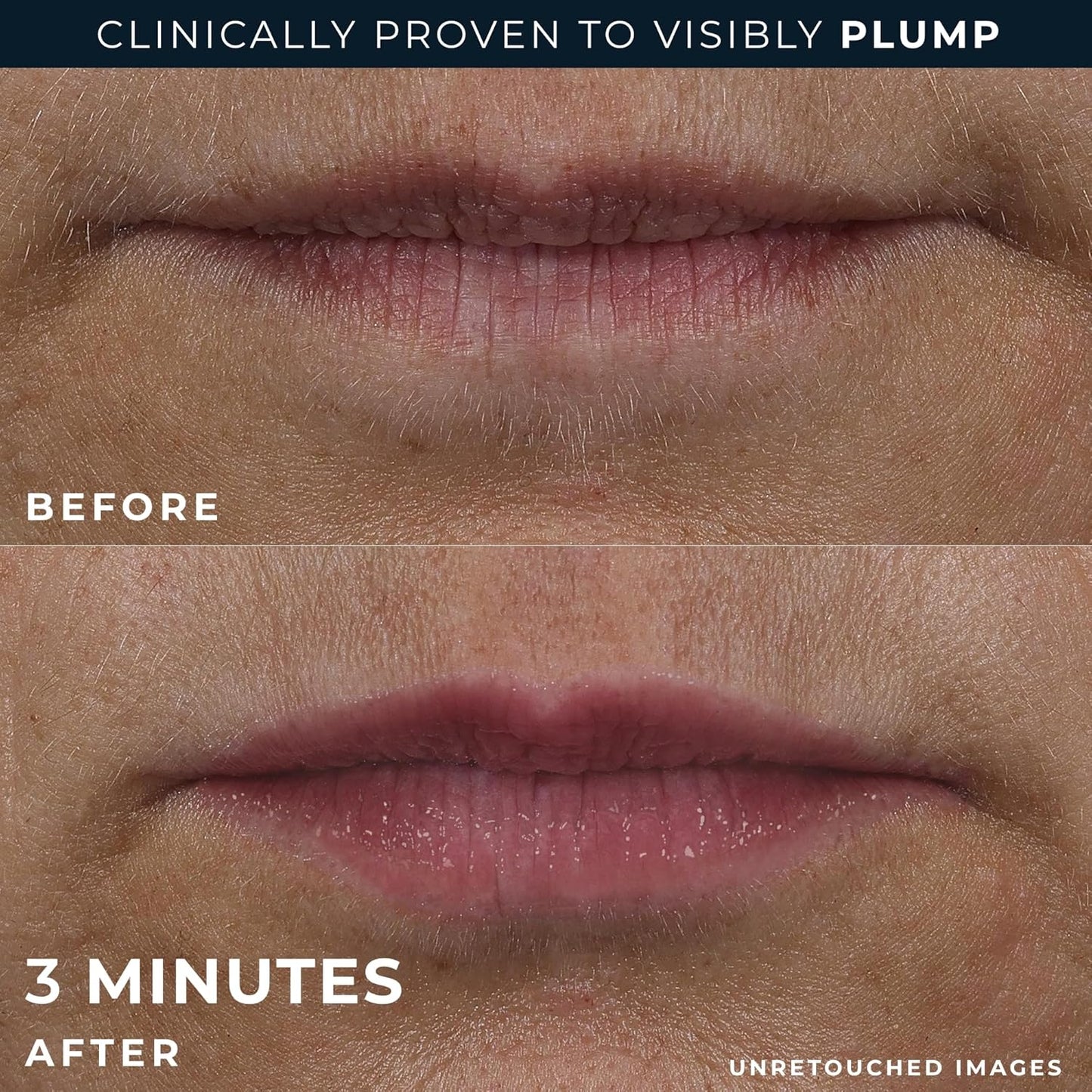 RoC Derm Correxion Lip Volumizer - Lip Plumper Peptide Treatment with Hyaluronic Acid & Vitamin E + Line Smoothing Eye Cream Packette